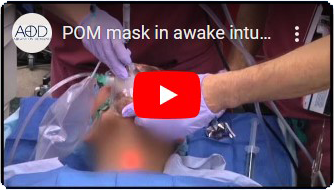 POM Mask used in endoscopy procedure
